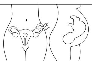 Gebärmutter, Sperma, Insemination. Befruchtung im Eileiter. Embryo im Bauch der Frau. Gynäkologie, Reproduktion. Fötale Babypositionen in der Gebärmutter während der Schwangerschaft. vektor