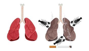 illustration von lungenraucher, lungenkrebserkrankung. das Konzept der Raucherentwöhnung. Vektor-Illustration. vektor