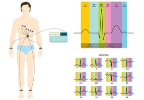 Ekg infografi vektor