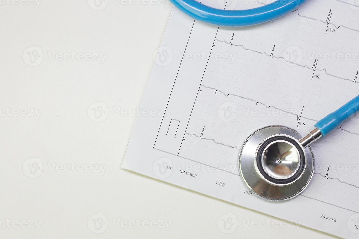 stéthoscopes bleus et tableau d'électrocardiographie en gros plan. photo