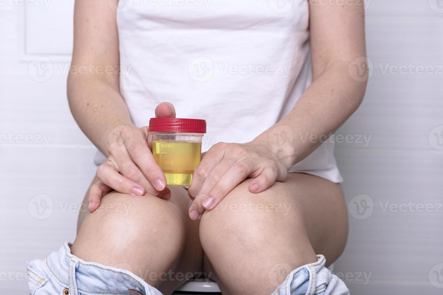 femme qui pisse tout en tenant un échantillon d'urine dans un récipient en plastique médical. photo