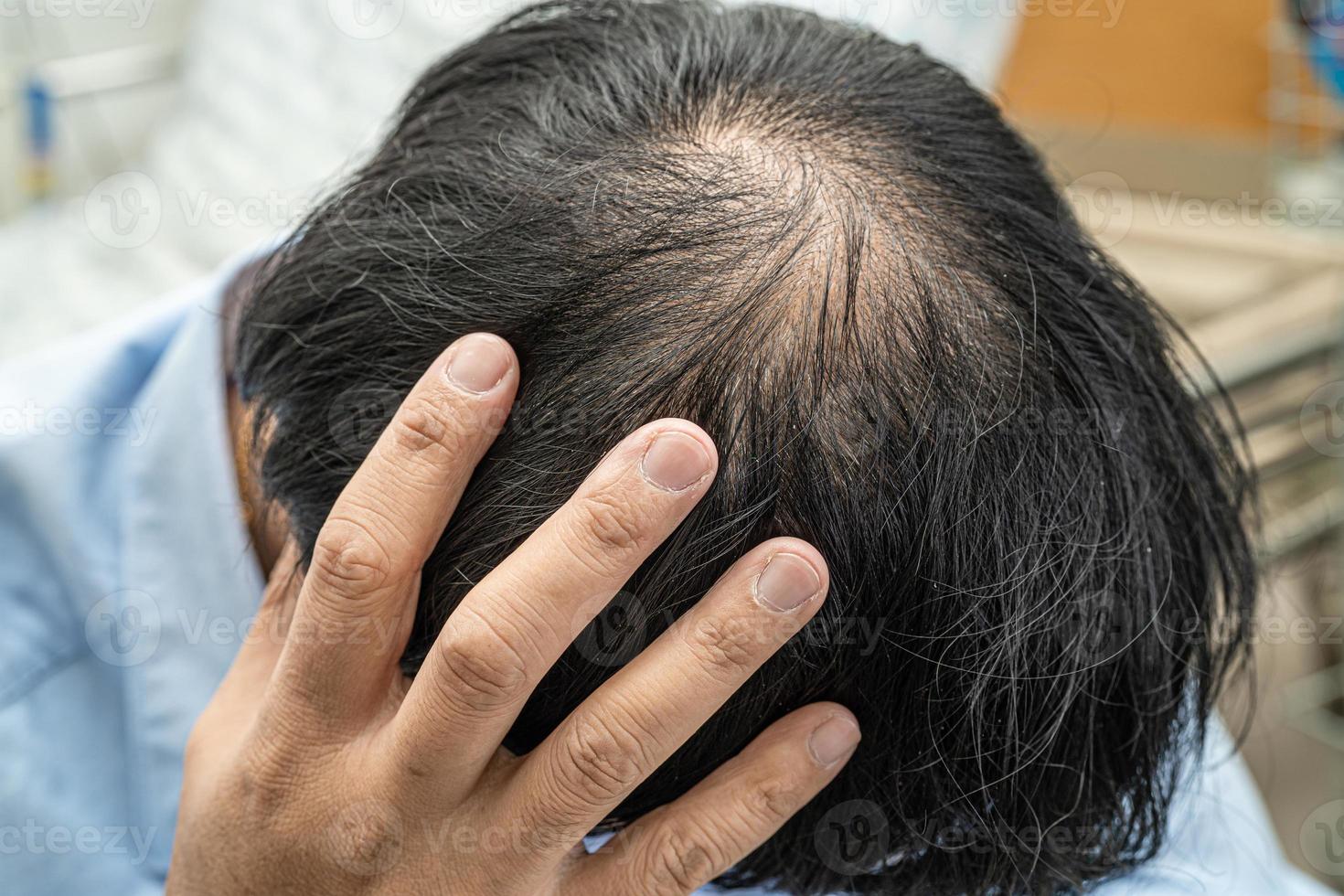 chauve au milieu de la tête et ne commence pas à perdre les cheveux glabres d'un homme de bureau actif et intelligent d'affaires asiatiques matures. photo