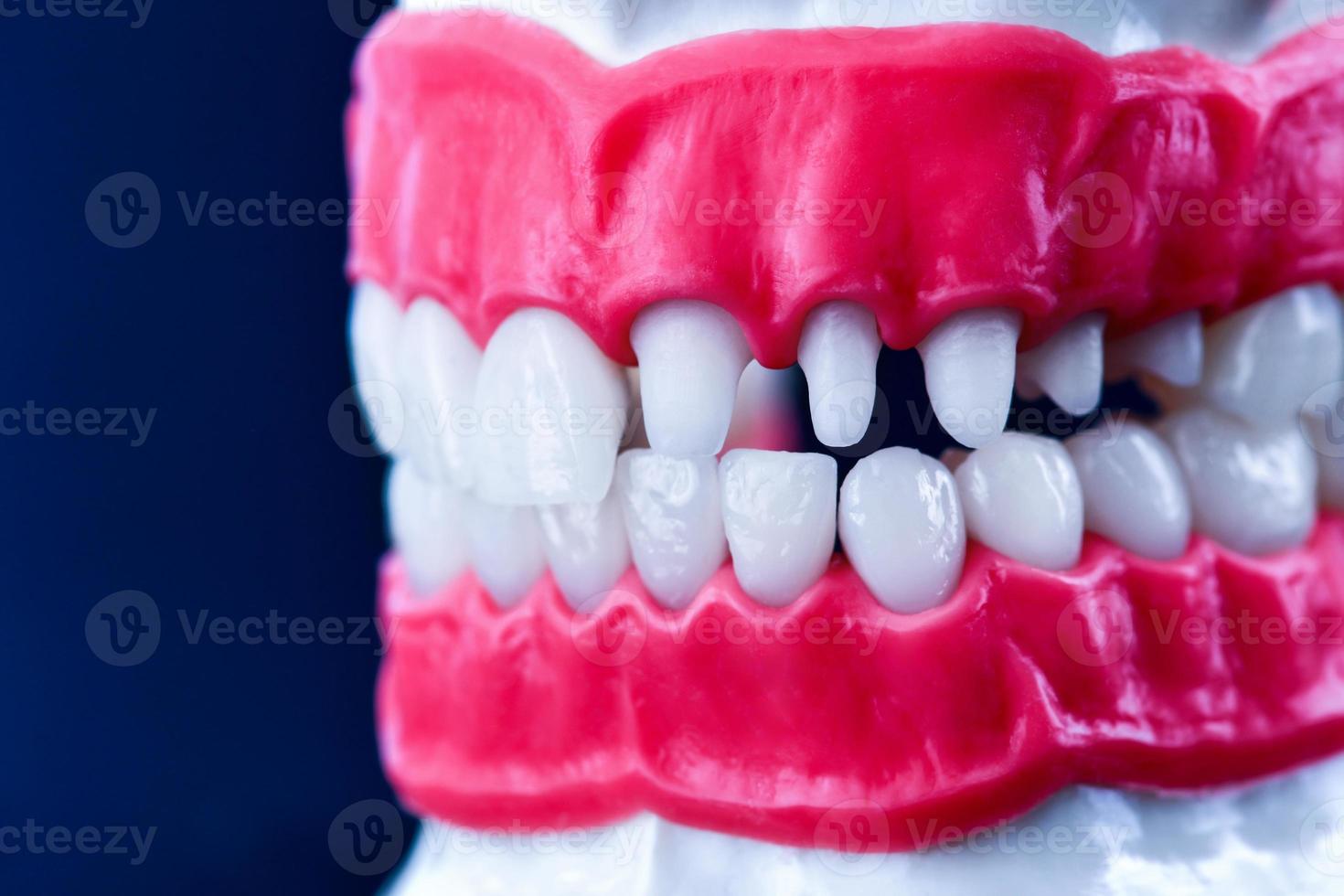 mâchoire humaine avec modèle d'anatomie des dents et des gencives photo