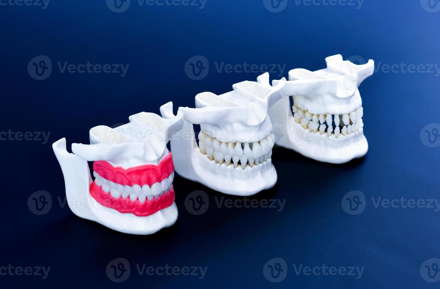 mâchoires humaines avec des modèles d'anatomie des dents et des gencives photo