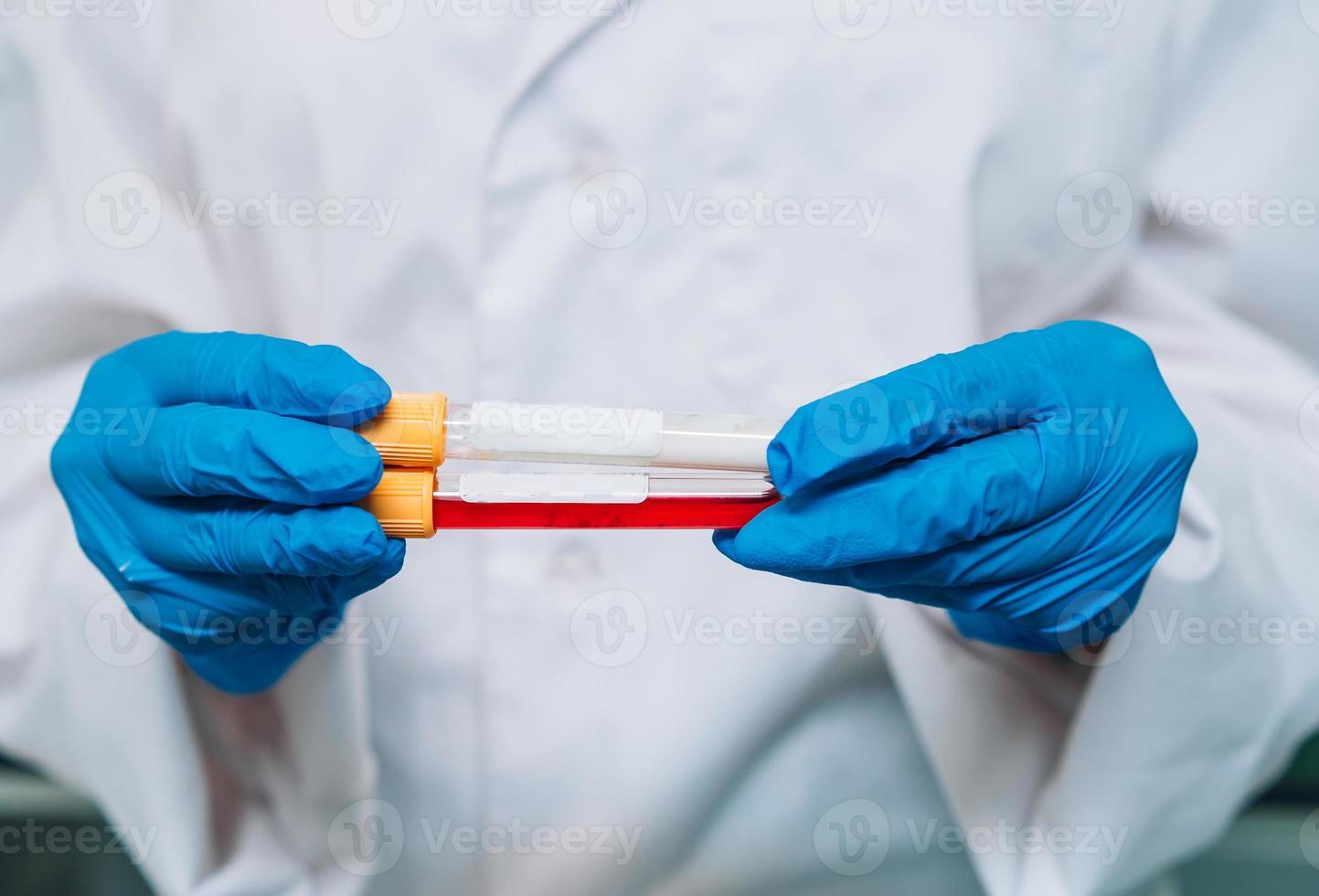 une chercheuse médicale ou scientifique tient dans les mains des tubes à essai photo