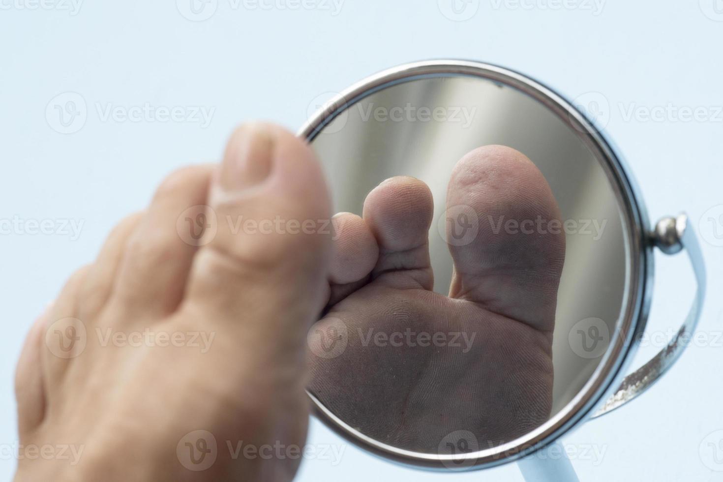 personne regardant la plante du pied dans un miroir, pour vérifier s'il n'y a pas de pied diabétique, comme d'éventuelles plaies photo