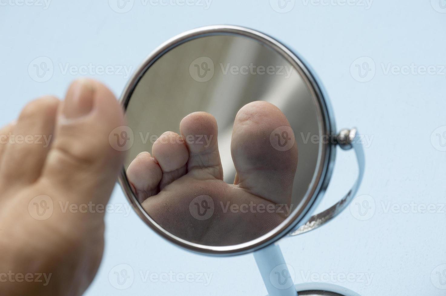 personne regardant la plante du pied dans un miroir, pour vérifier s'il n'y a pas de pied diabétique, comme d'éventuelles plaies photo