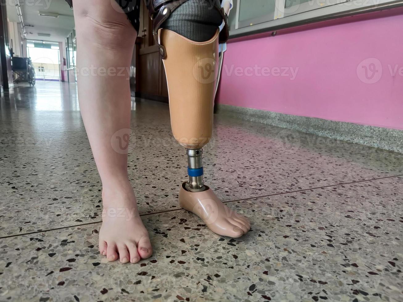 les jeunes femmes handicapées essaient de marcher avec des prothèses photo