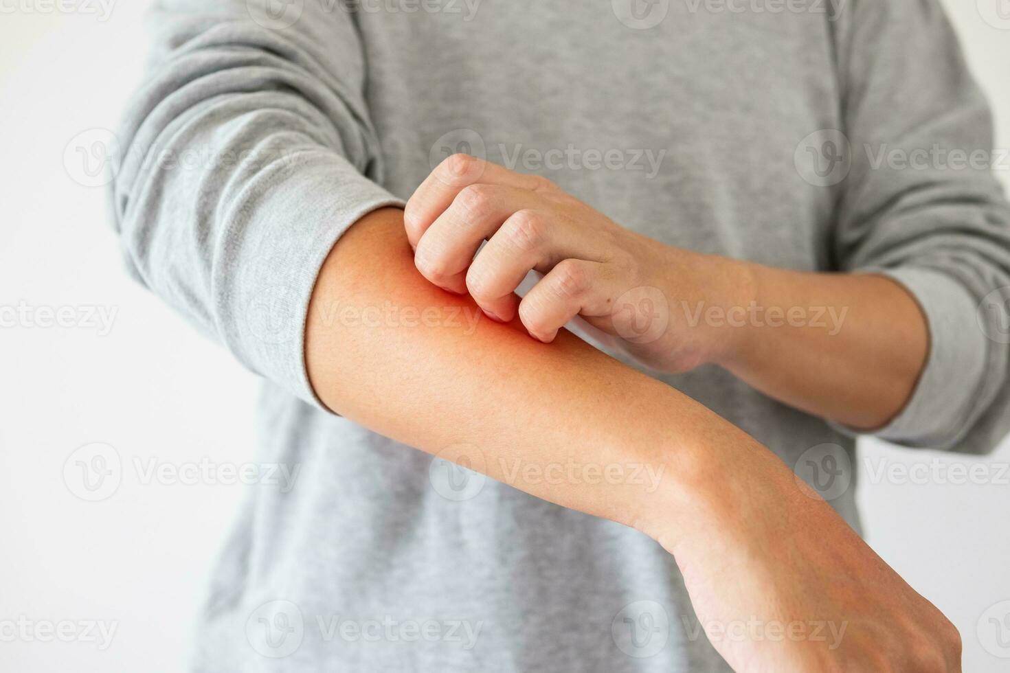 jeune homme asiatique qui démange et se gratte le bras à cause de la dermatite de l'eczéma de la peau sèche qui démange photo