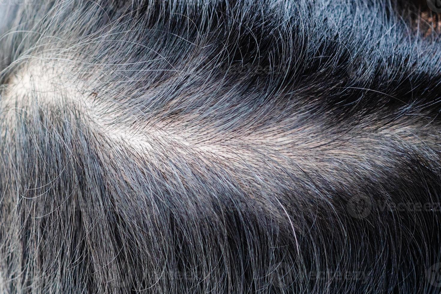 Gros plan sur le problème de perte de cheveux sur la tête photo