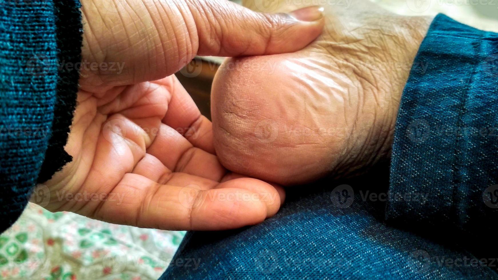 un homme montre des talons secs et sales photo