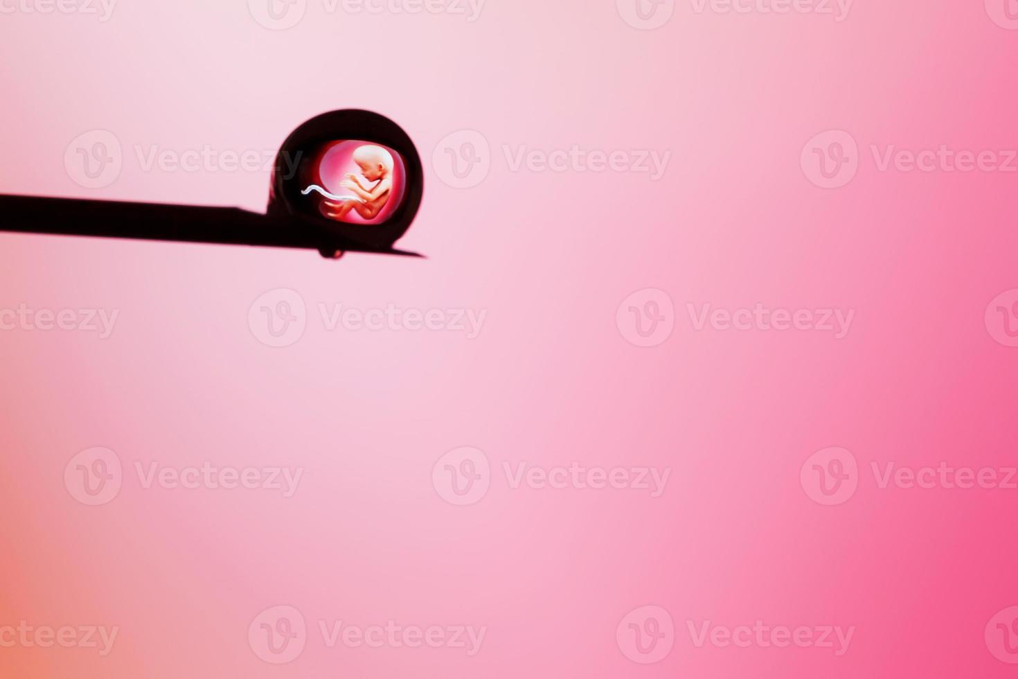 embryon humain dans une goutte sur la pointe d'une aiguille sur fond rose. éditorial illustratif photo