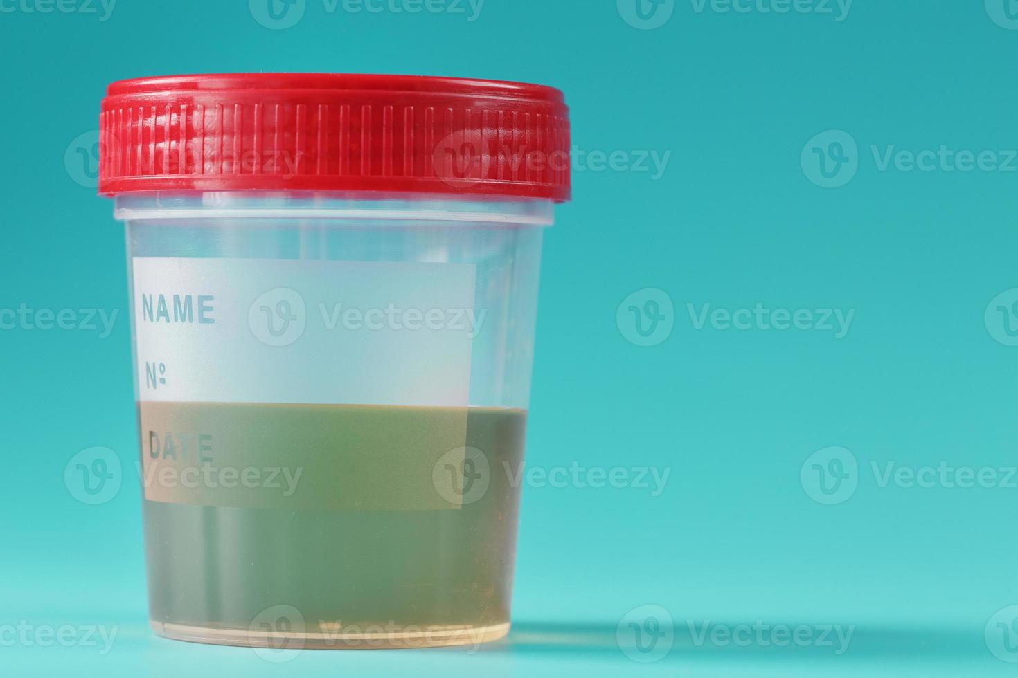 un conteneur pour biomatériaux avec une analyse d'urine et un couvercle rouge sur fond cyanique. photo
