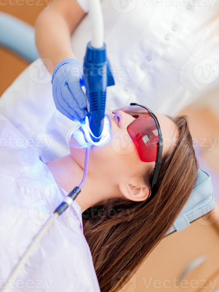 blanchiment des dents au laser photo