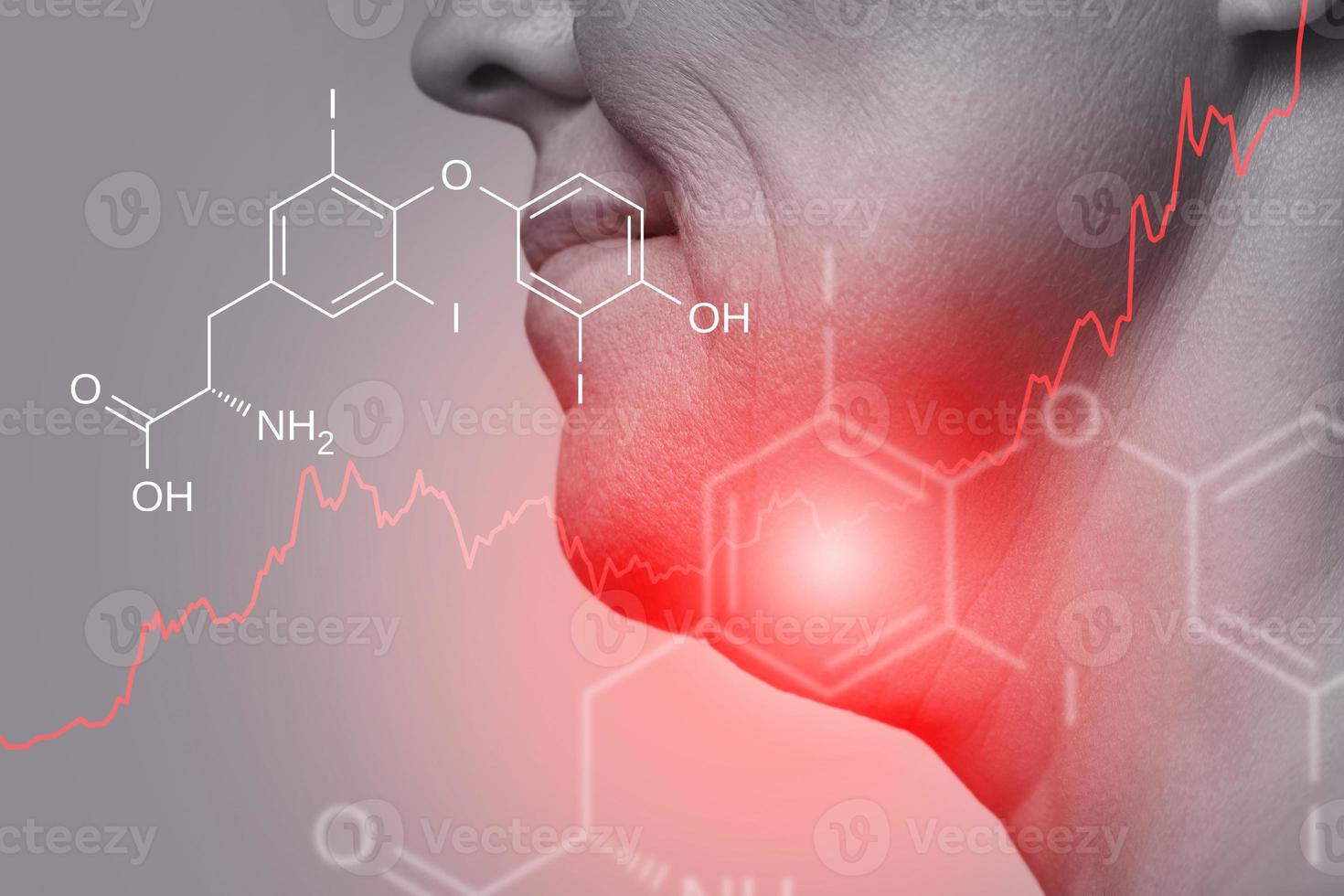 formule du cou féminin et de l'hormone triiodothyronine photo