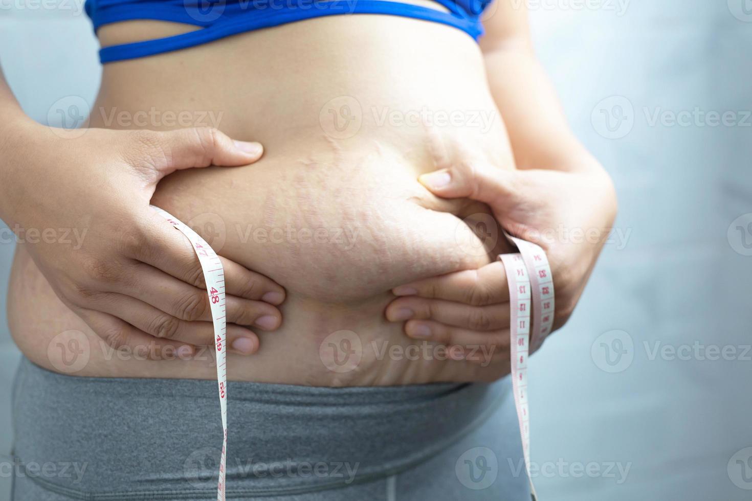 une femme obèse a besoin de contrôler son poids, elle a un excès de graisse. photo