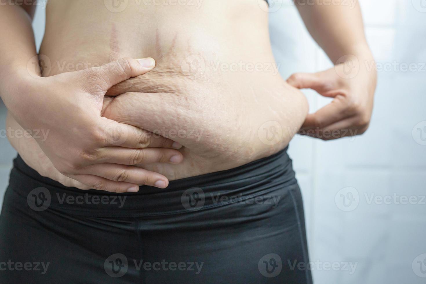 une femme obèse a besoin de contrôler son poids, elle a un excès de graisse. photo