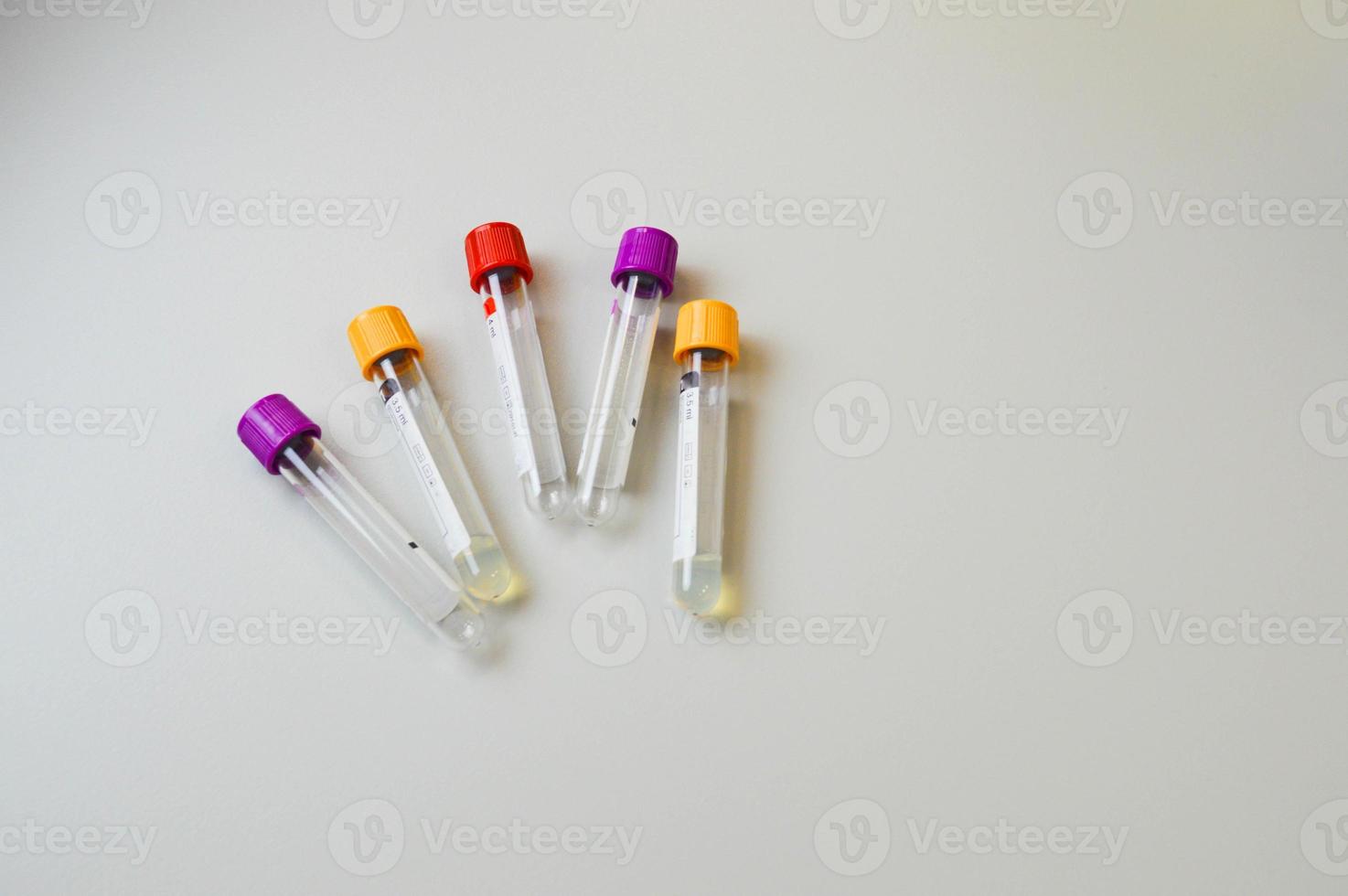 tubes à essai avec des échantillons de sang sur table en laboratoire. recherche sur les virus photo