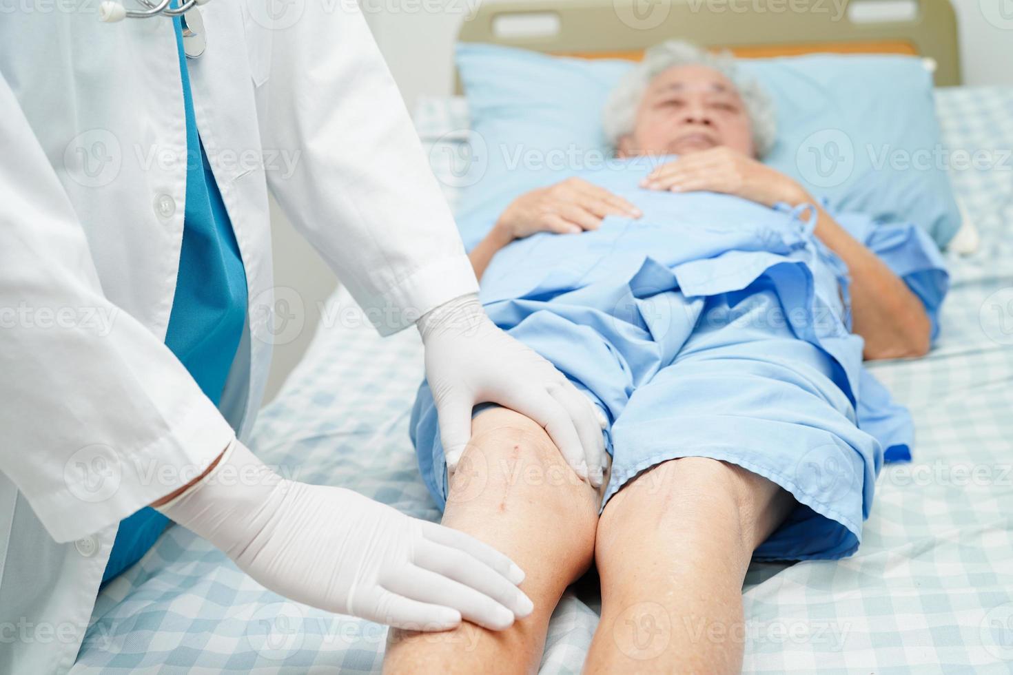 médecin vérifiant une patiente âgée asiatique avec une chirurgie de remplacement du genou cicatriciel à l'hôpital. photo