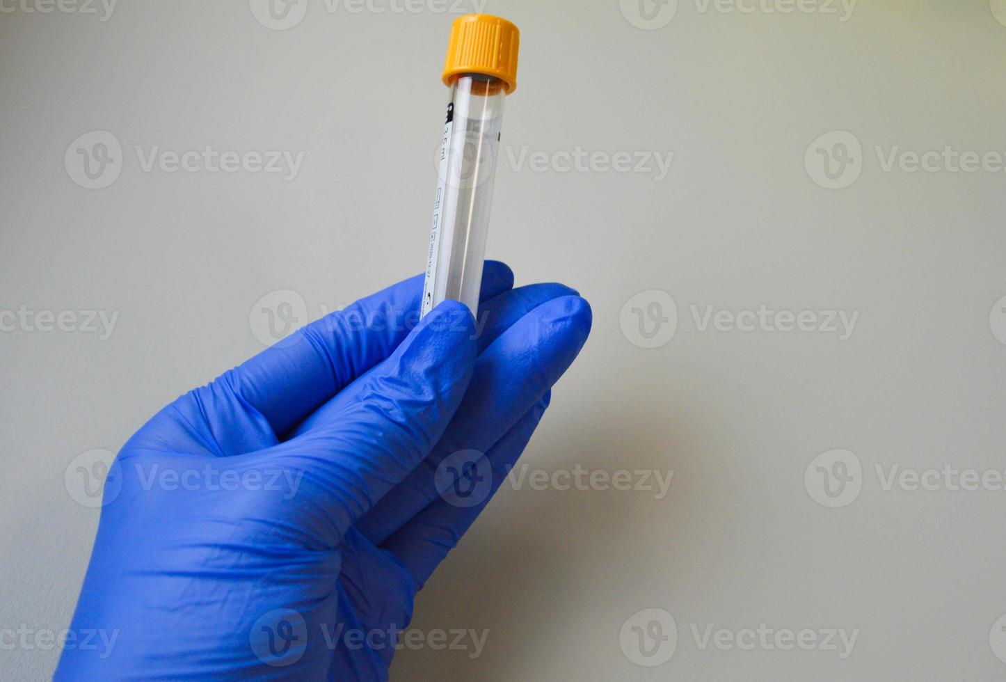 gros plan sur un tube de verre avec un liquide bleu dans la main d'un scientifique pendant un test médical photo
