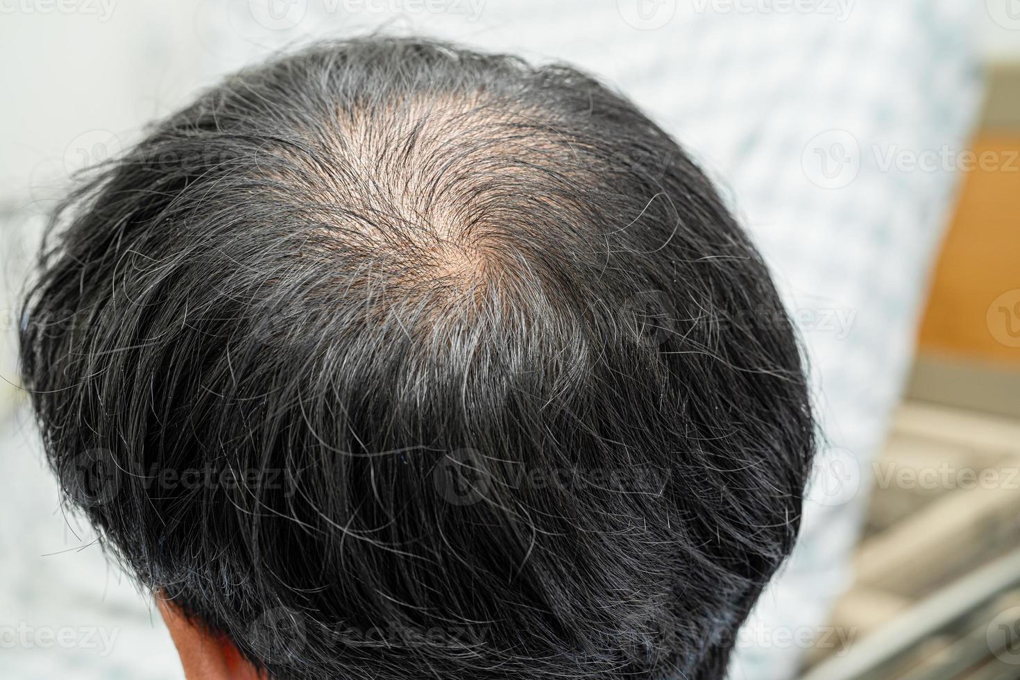 chauve au milieu de la tête et ne commence pas à perdre les cheveux glabres d'un homme de bureau actif et intelligent d'affaires asiatiques matures. photo