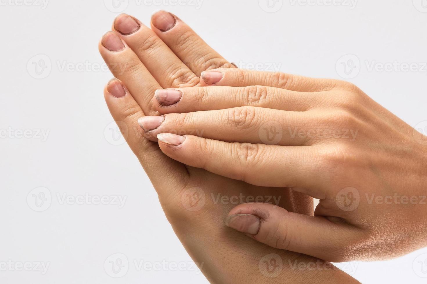 mains féminines avec des ongles sales sur fond gris photo