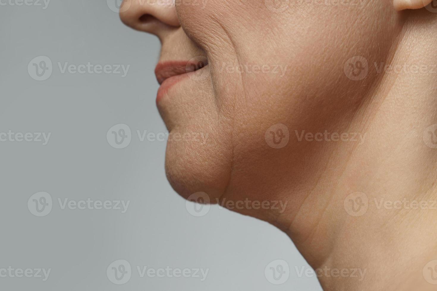 gros plan du menton et du cou féminins avec des lignes d'expression photo