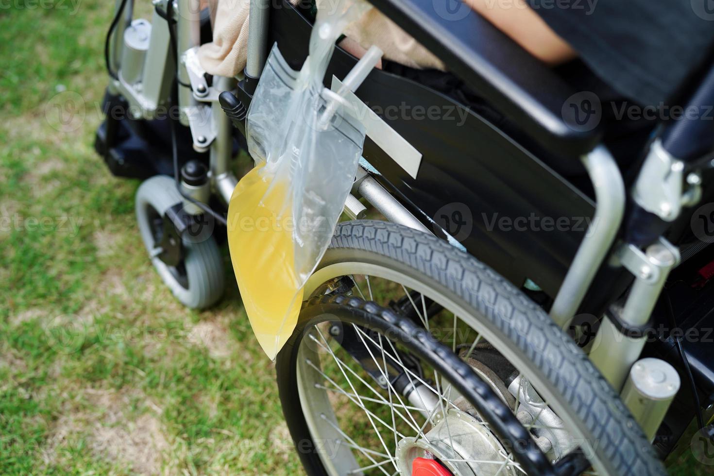 femme handicapée asiatique avec sac d'urine sur fauteuil roulant. photo