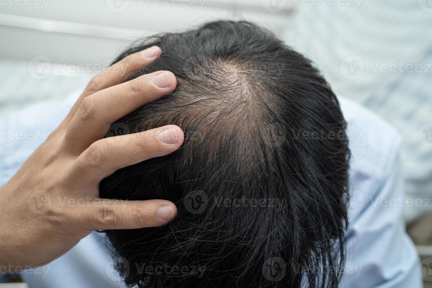 chauve au milieu de la tête et ne commence pas à perdre les cheveux glabres d'un homme de bureau actif et intelligent d'affaires asiatiques matures. photo