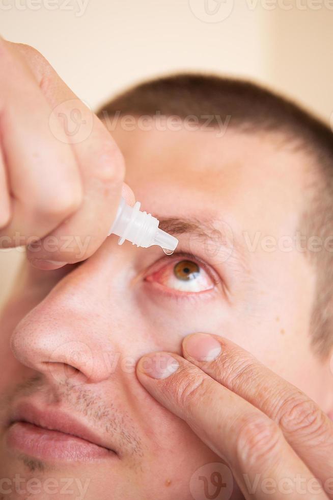 prendre soin de ses yeux. portrait d'un jeune homme dégoulinant de gouttes dans ses yeux. fermer. photo