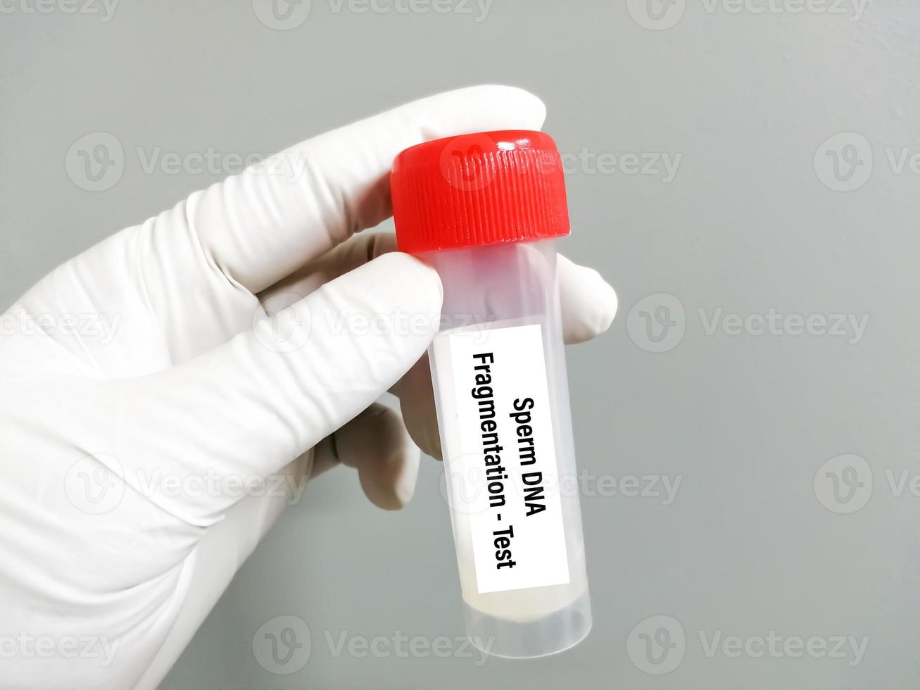 scientifique en portant échantillon récipient avec sperme pour ADN fragmentation test. photo