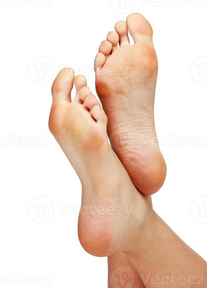 femelle pieds avec callosités, isolé sur blanc photo