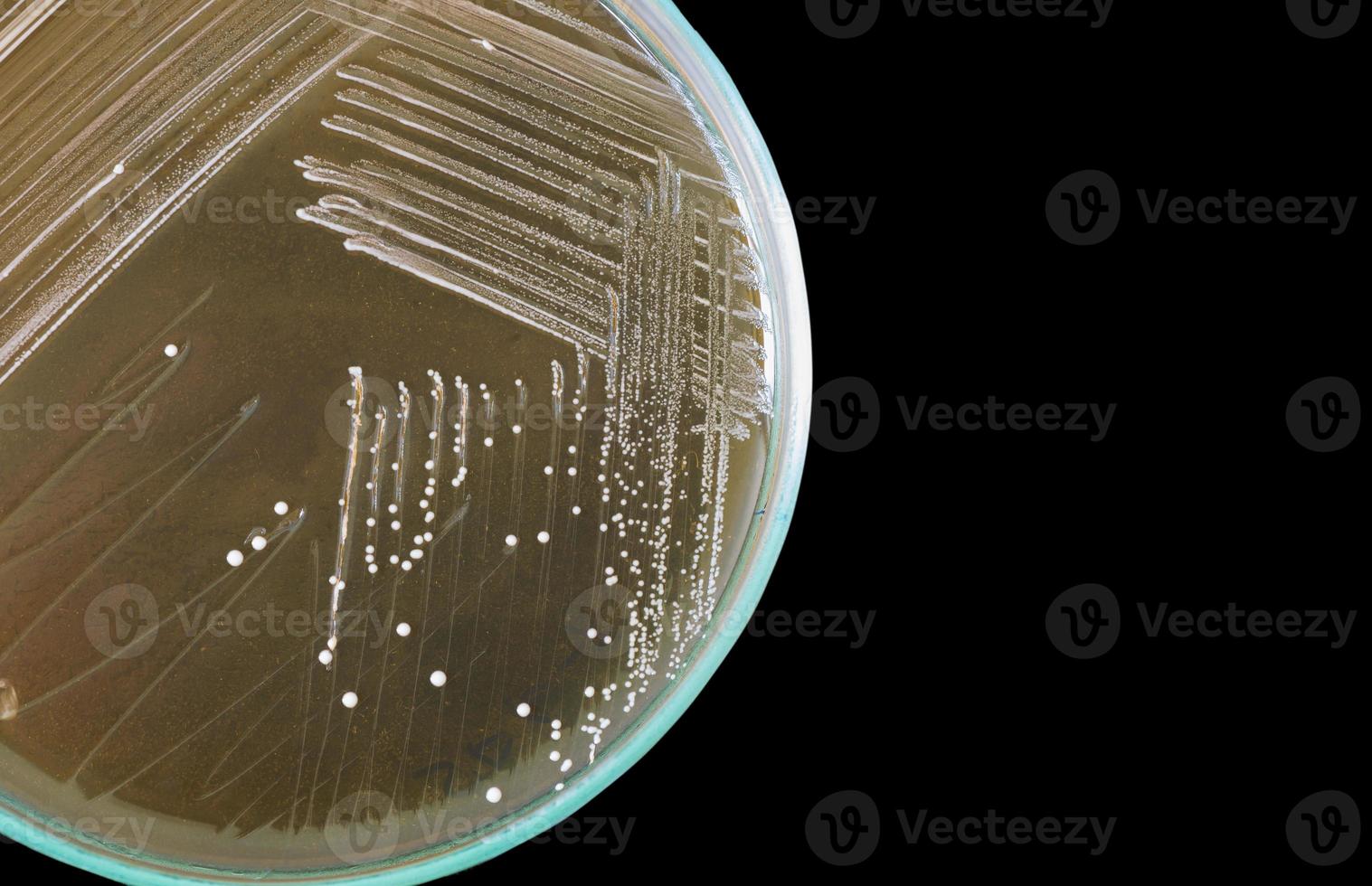 macro de les bactéries sur pétri plat isolé sur noir Contexte photo