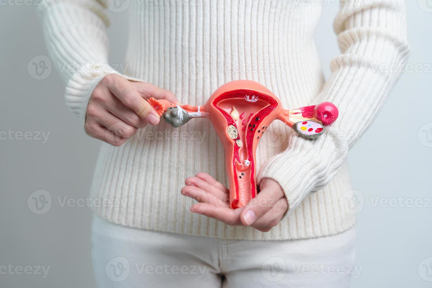 femme tenant le modèle de l'utérus et des ovaires. cancer de l'ovaire et du col de l'utérus, trouble du col de l'utérus, endométriose, hystérectomie, fibromes utérins, système reproducteur et concept de grossesse photo