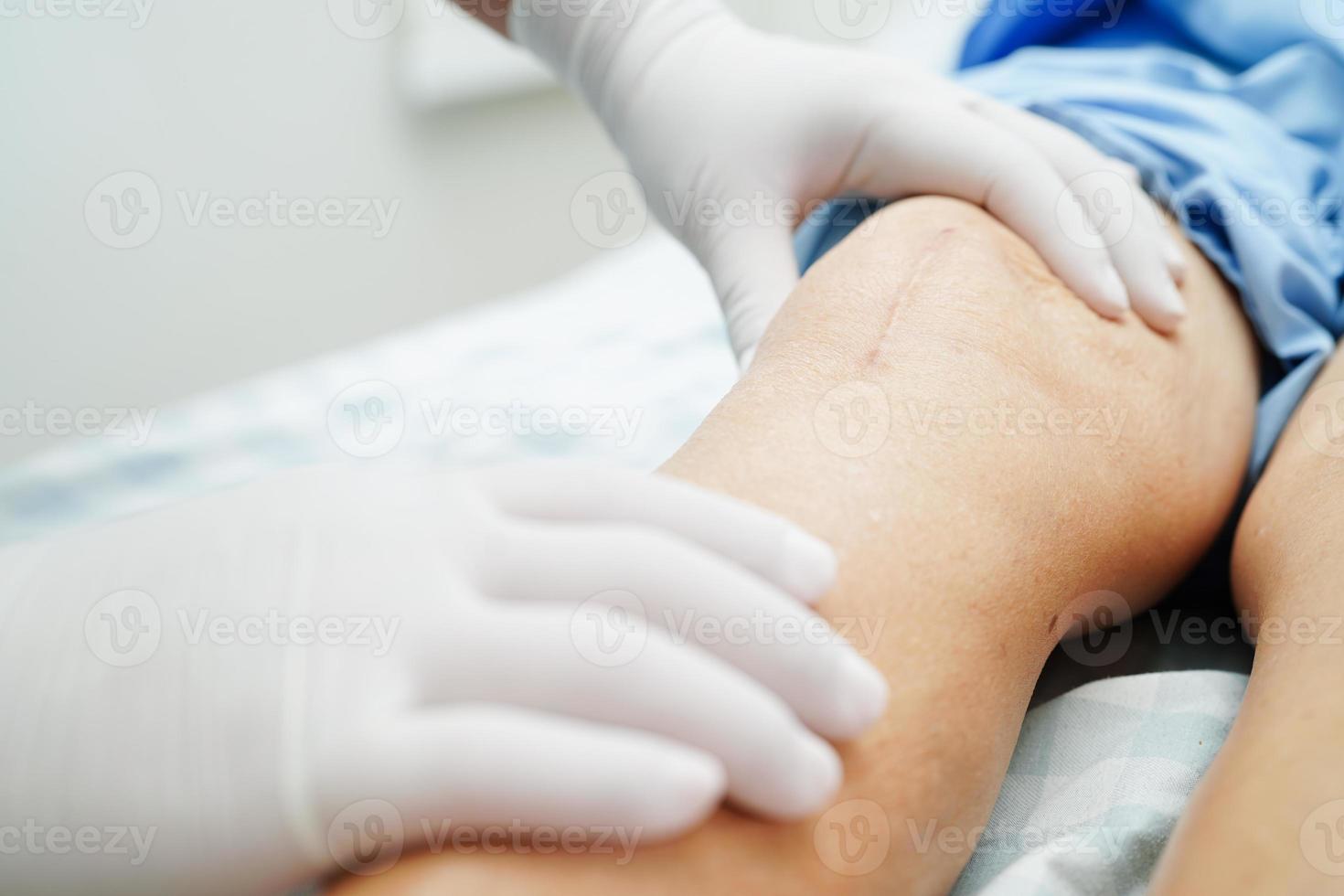 femme âgée asiatique patiente avec chirurgie de remplacement du genou cicatriciel à l'hôpital. photo