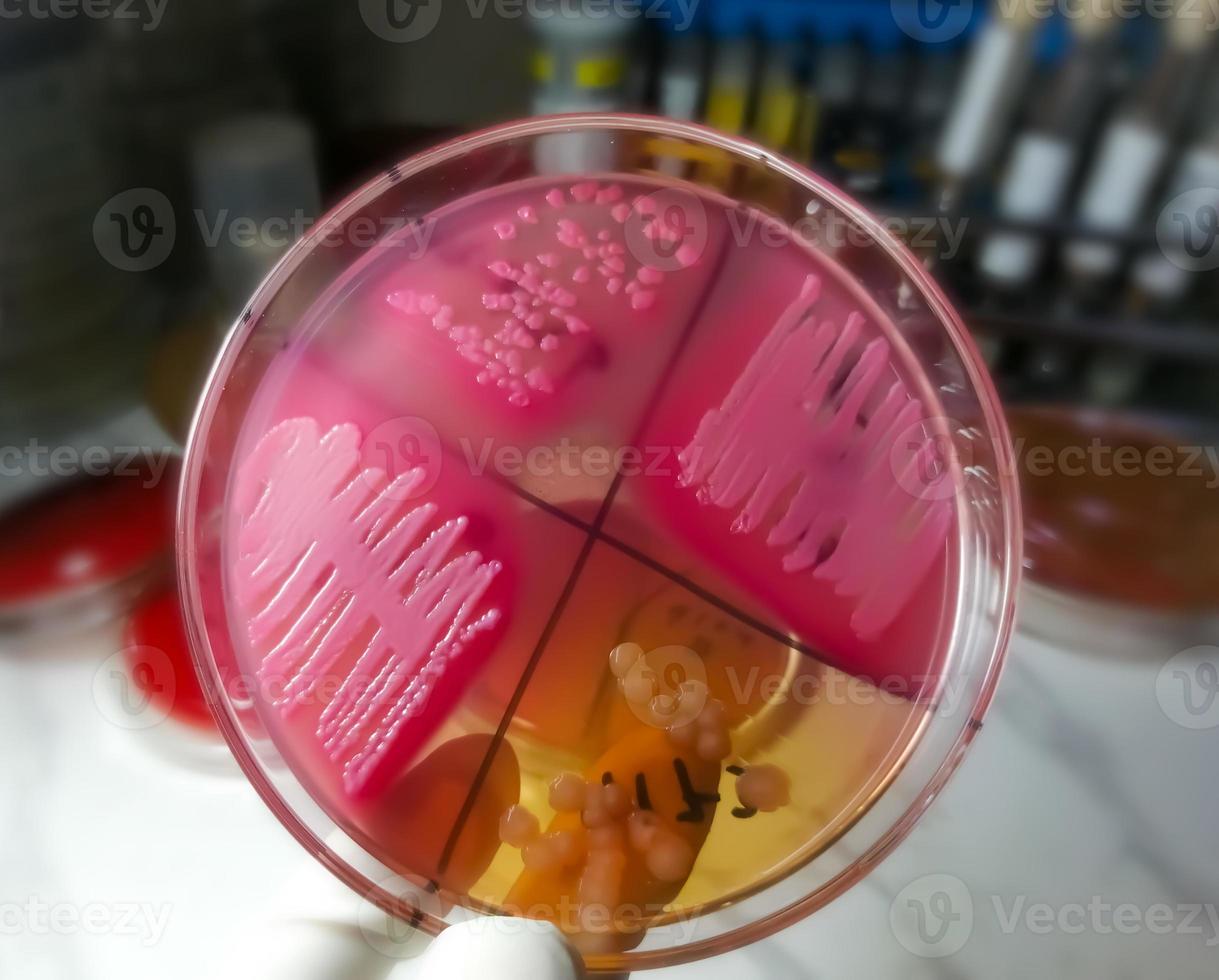 les bactéries colonie sur culture médias plaque. bactérien culture essai. photo