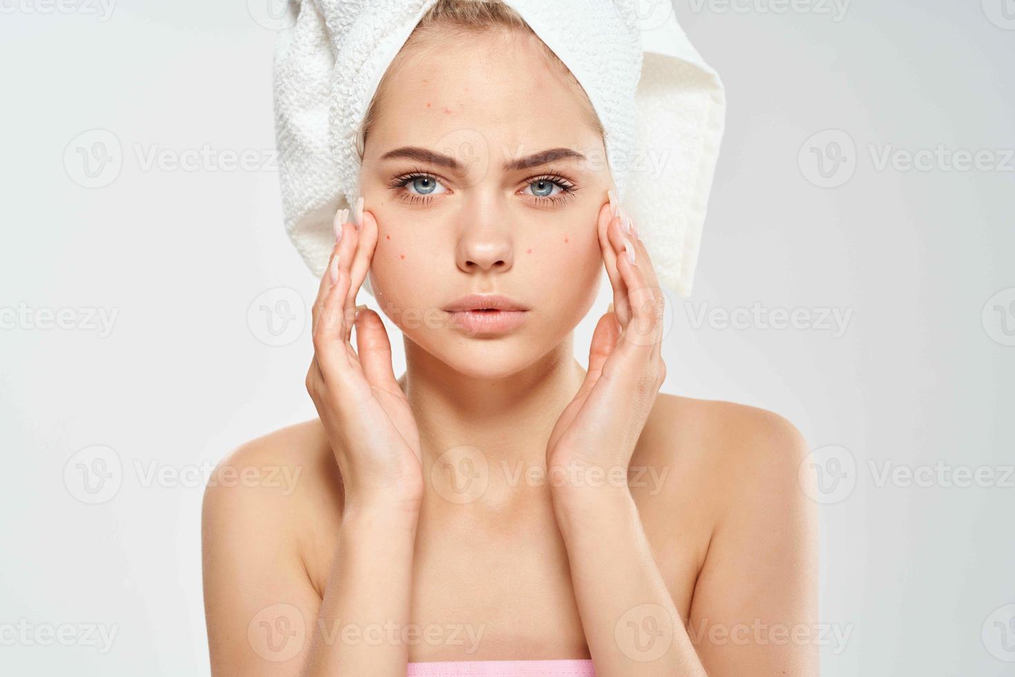 jolie femme avec nu épaules peau problèmes visage santé acné photo