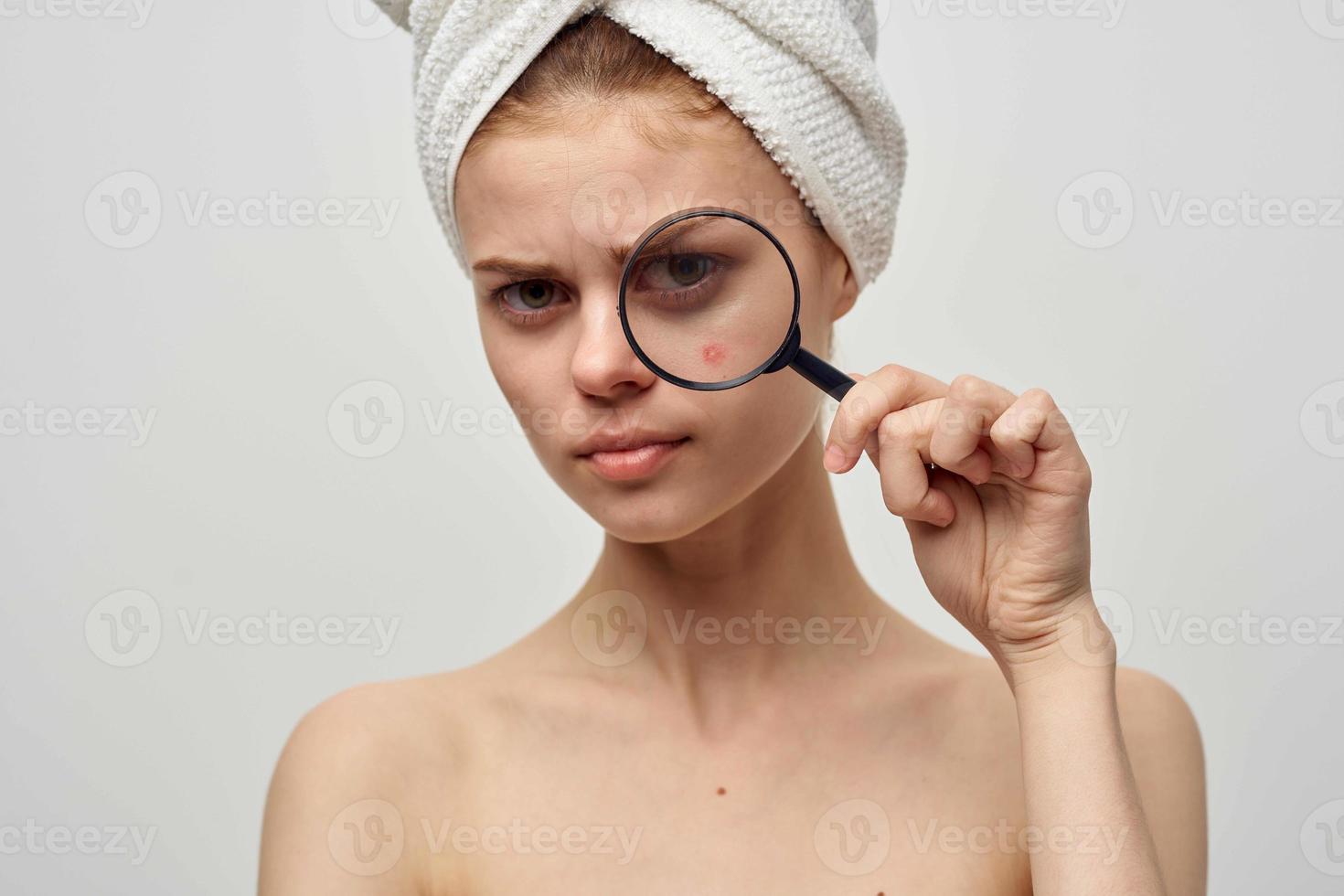 jolie femme avec une bouton sur le visage hygiène traitement photo