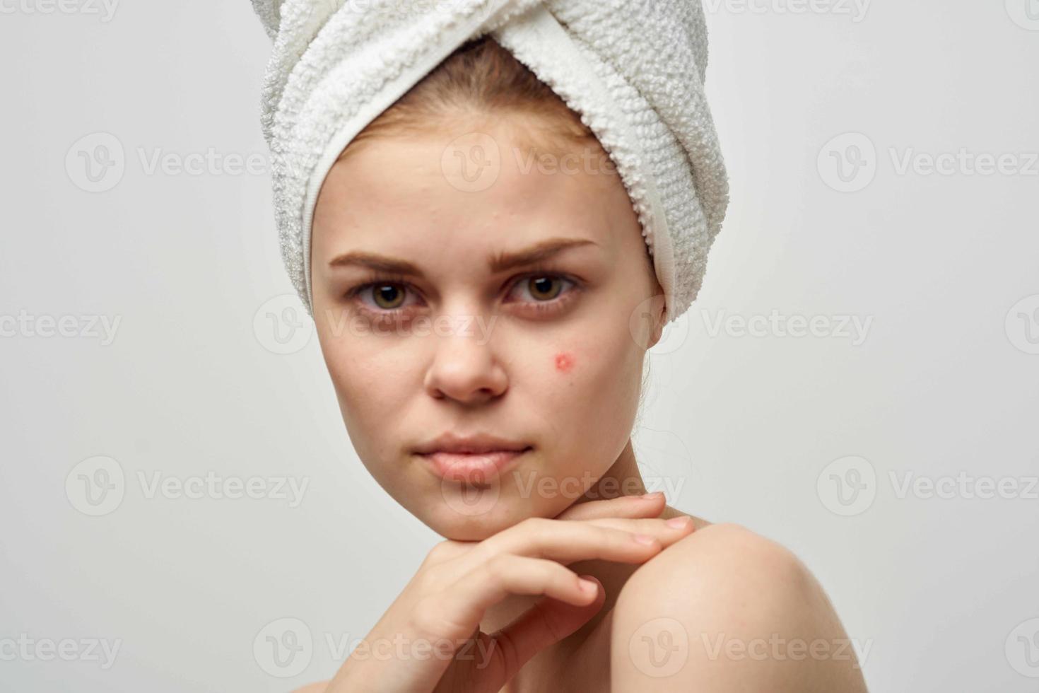 jolie femme avec une bouton sur le visage peau problèmes fermer photo