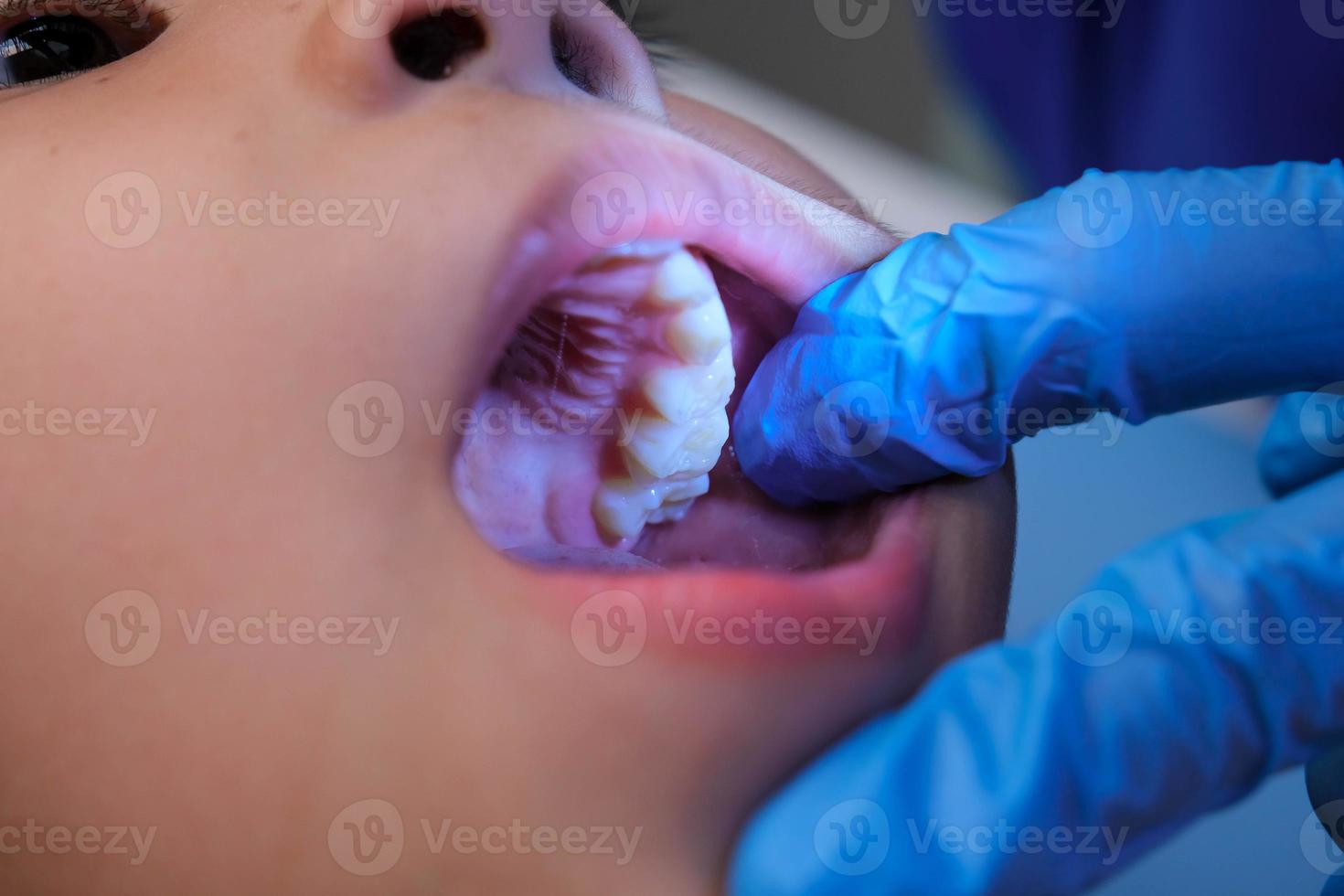 fermer à l'intérieur le oral cavité de une en bonne santé enfant avec magnifique Lignes de bébé dents. Jeune fille ouvre bouche révélateur plus haut et inférieur dents, difficile palais, doux palais, dentaire et oral santé vérification. photo