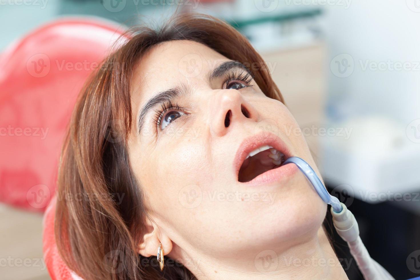 magnifique femme ayant dentaire traitement à dentiste bureau. photo