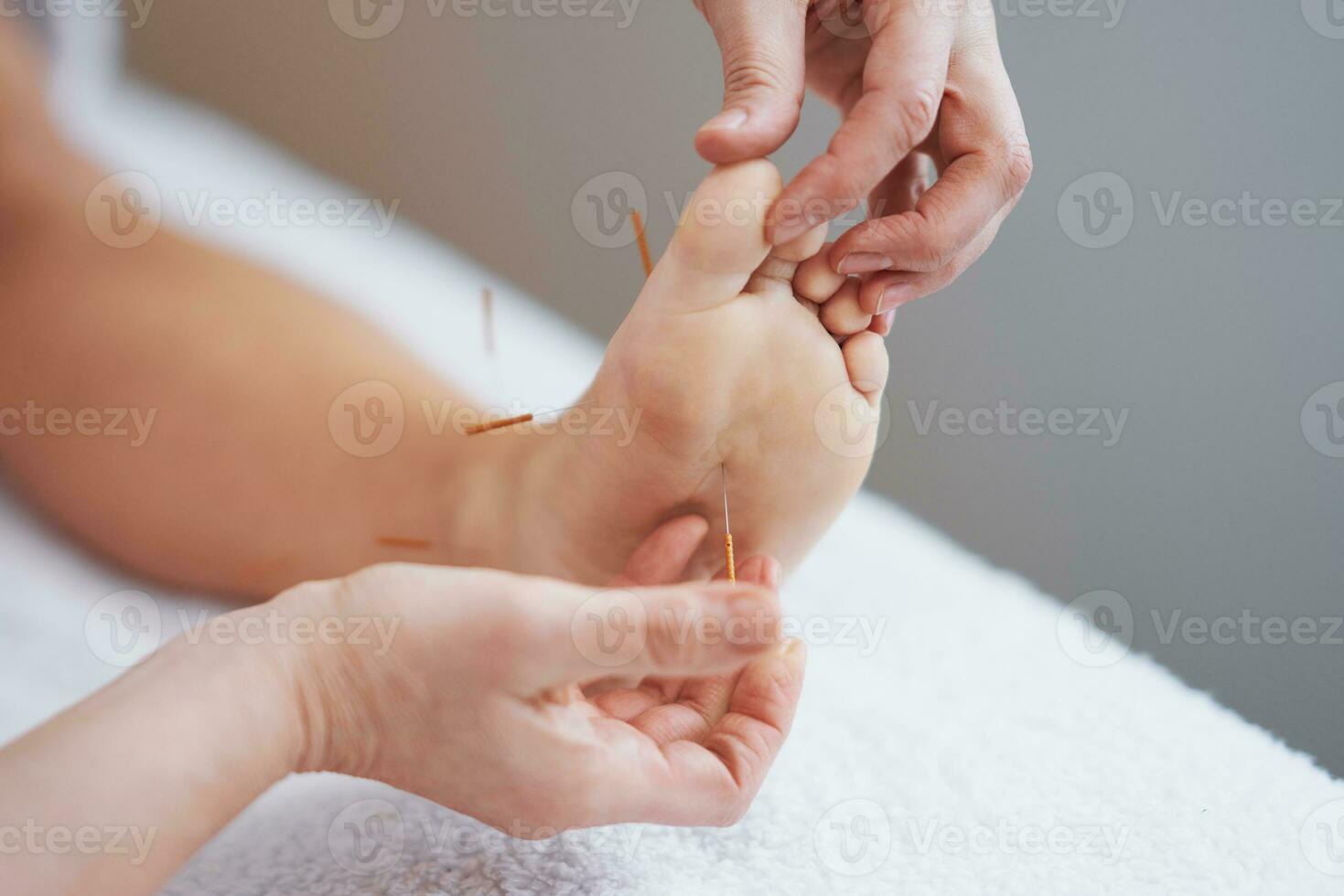 une acupuncture aiguille thérapie dans le studio photo