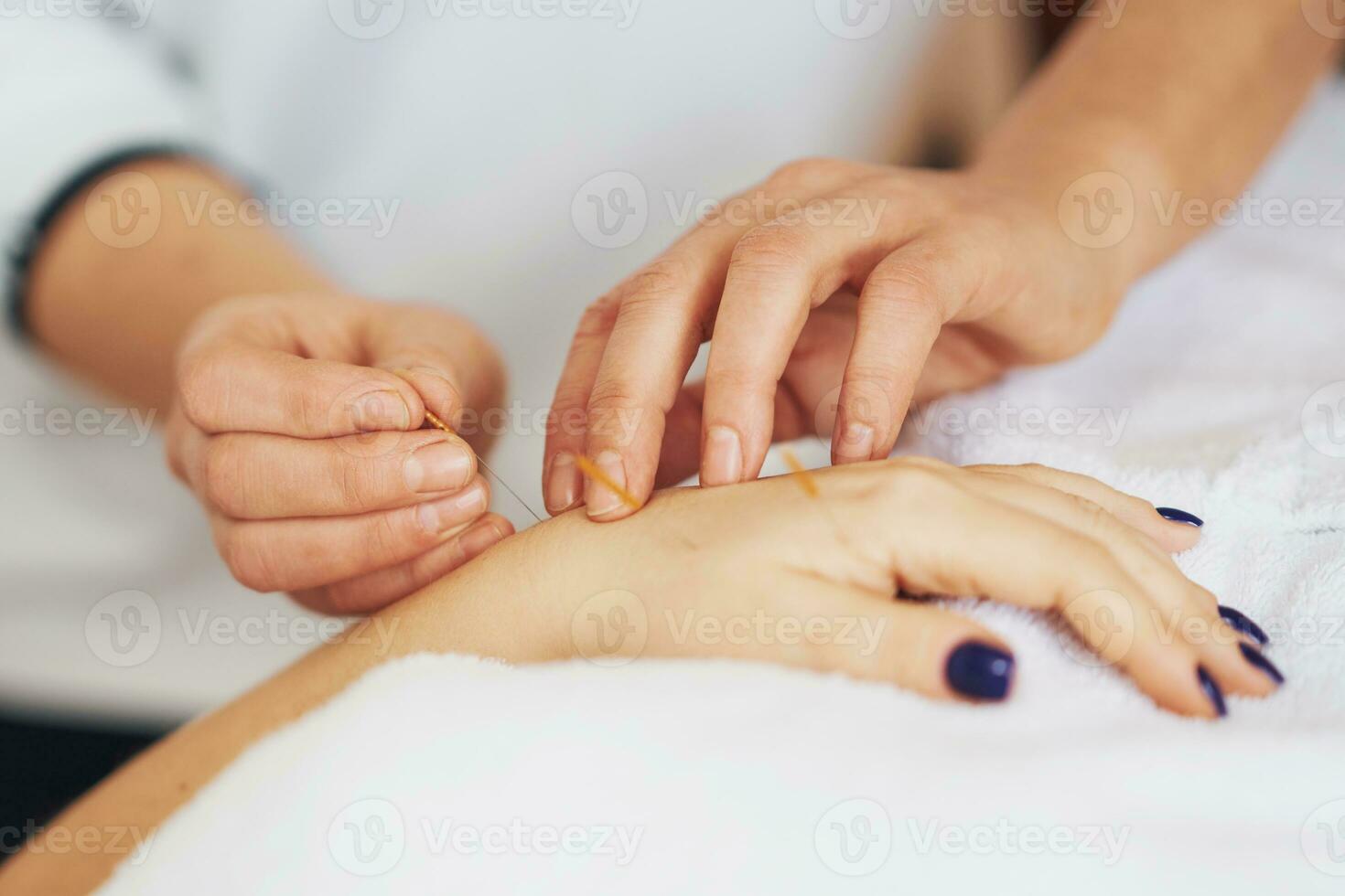 une acupuncture aiguille thérapie dans le studio photo