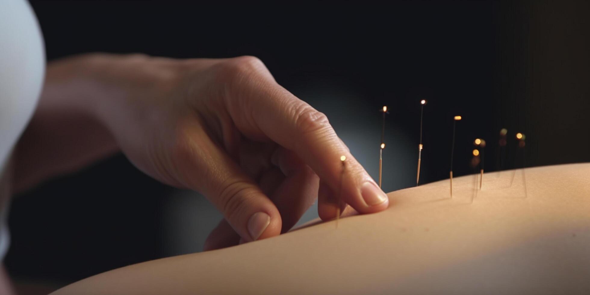 fermer de acupuncture aiguilles inséré dans peau avec mains mis sur Haut ai généré photo