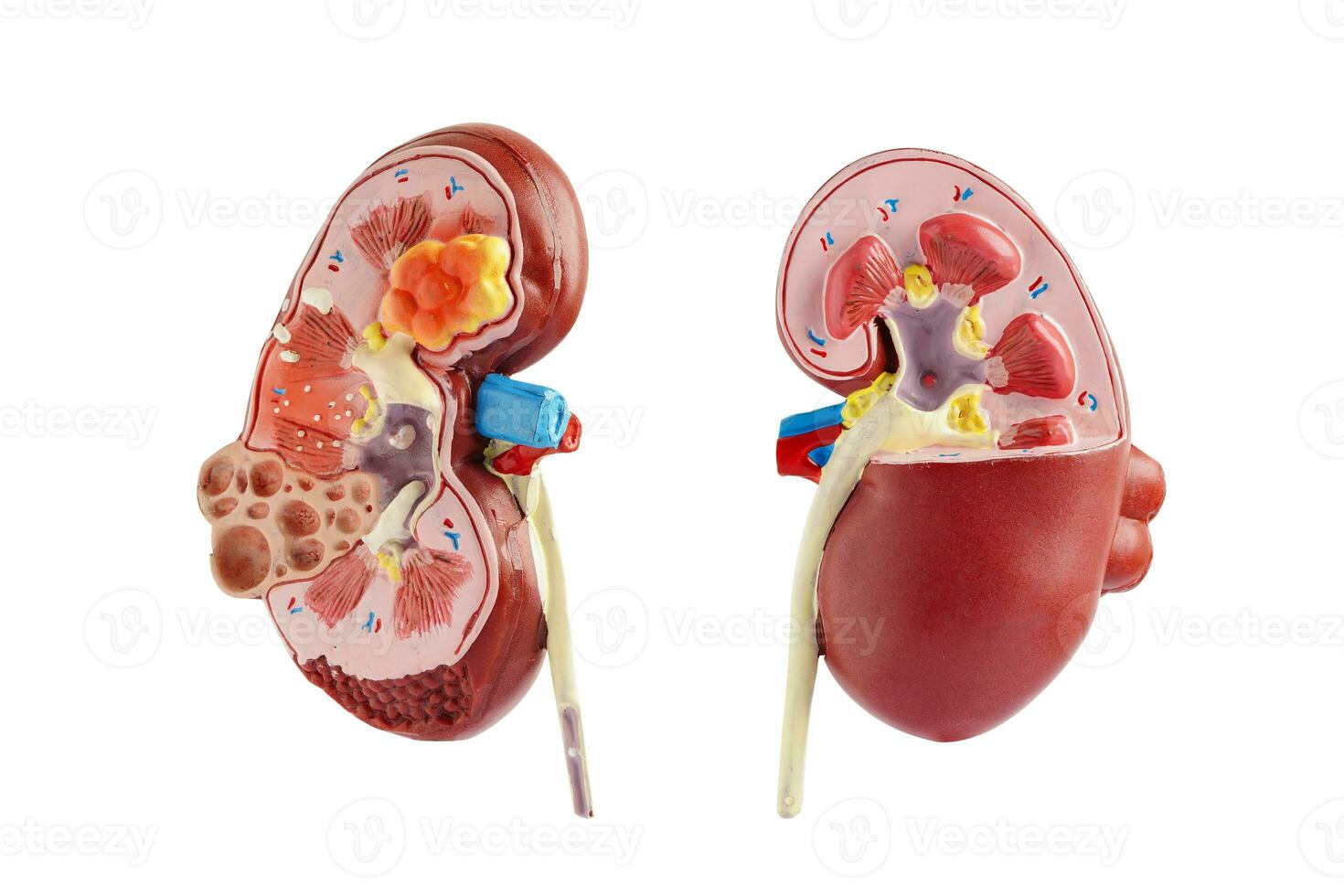 un rein modèle isolé sur blanc Contexte avec coupure chemin. chronique un rein maladie, traitement urinaire système, urologie, estimé glomérulaire filtration taux egfr. photo