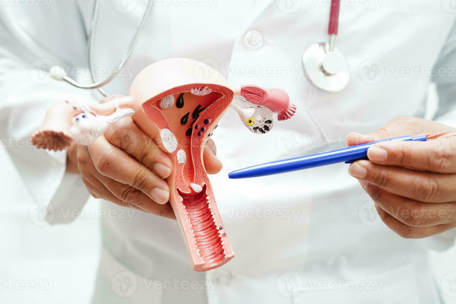 utérus, médecin en portant anatomie modèle pour étude diagnostic et traitement dans hôpital. photo