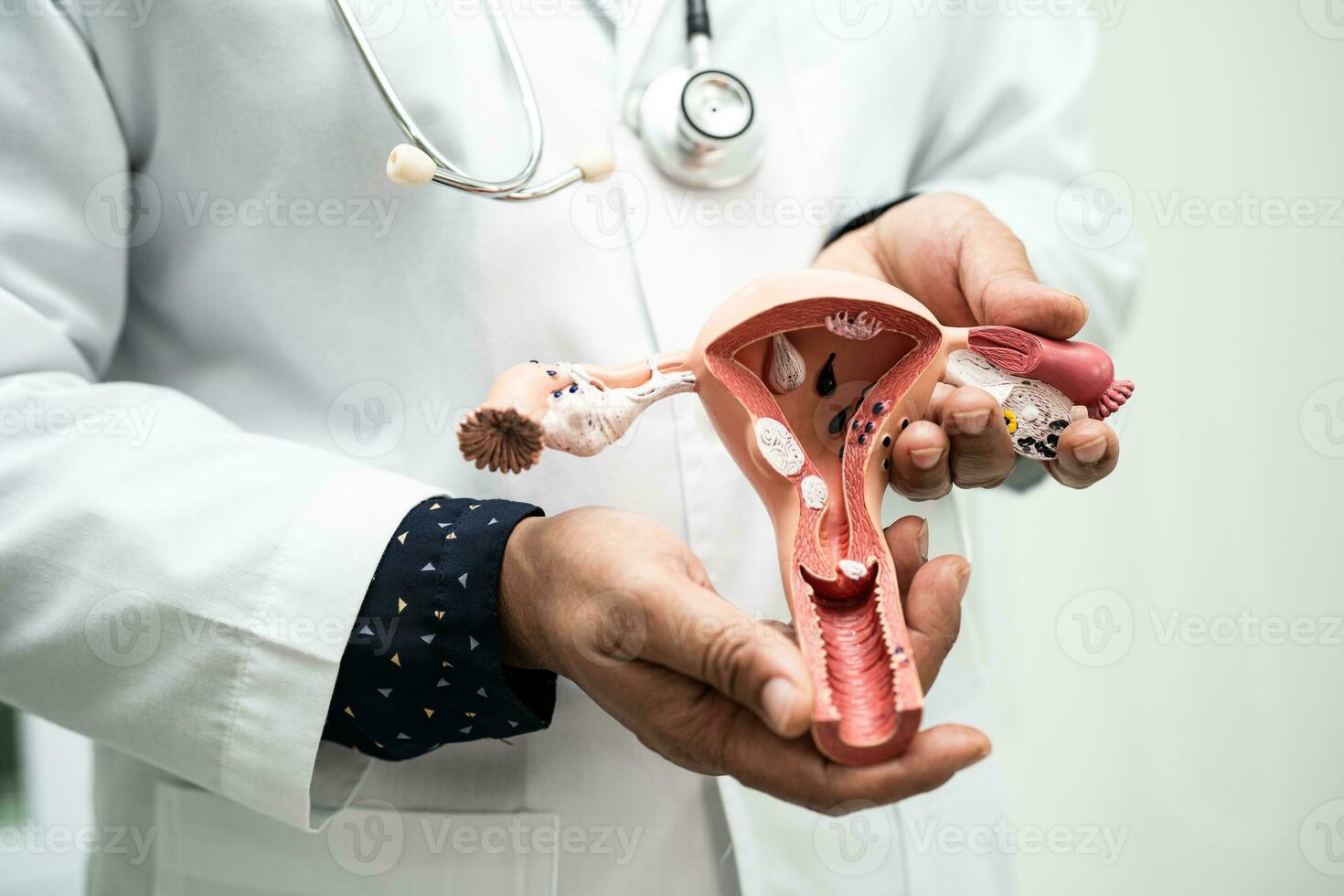 utérus, médecin en portant anatomie modèle pour étude diagnostic et traitement dans hôpital. photo