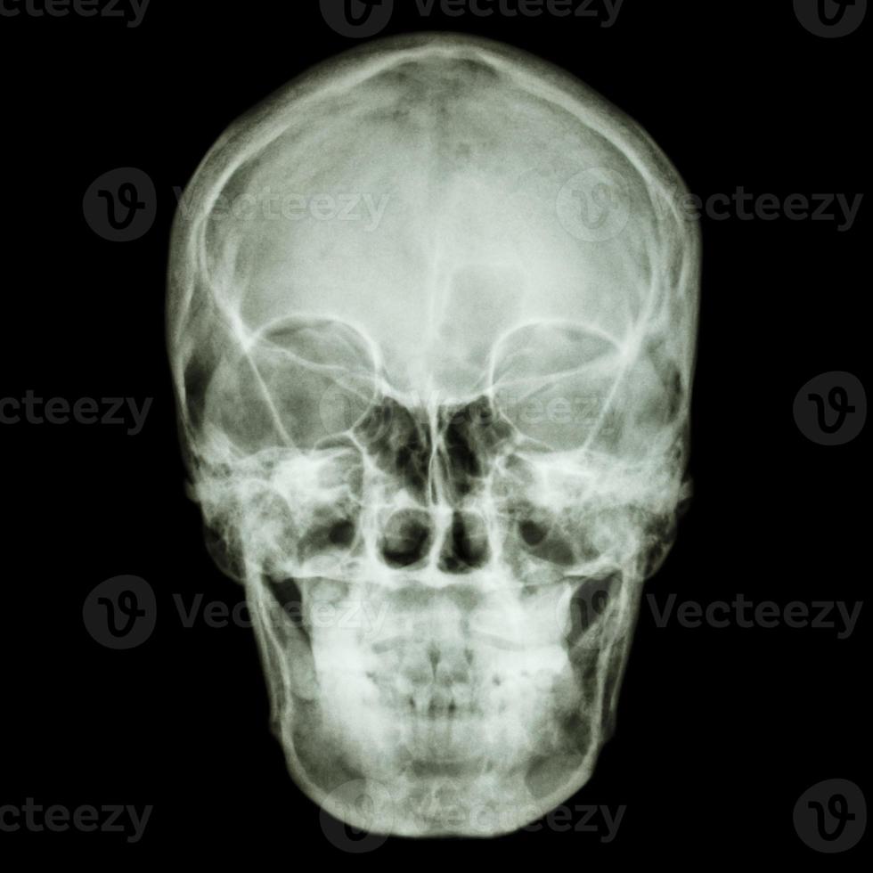 film x ray le crâne du peuple asiatique photo