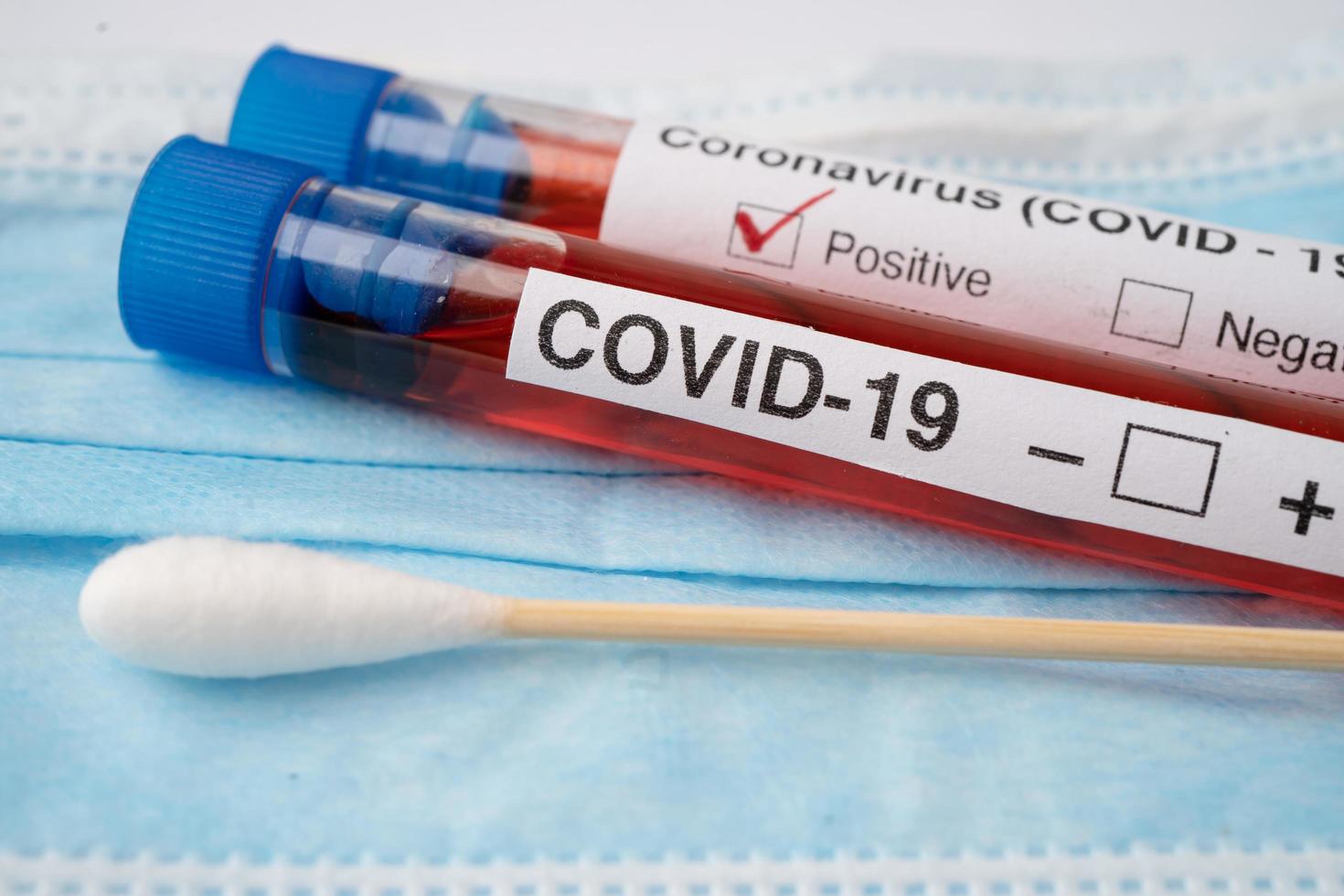 Tube à essai de sang de l'échantillon de virus ou de coronavirus covid 19 dans le laboratoire de l'hôpital photo