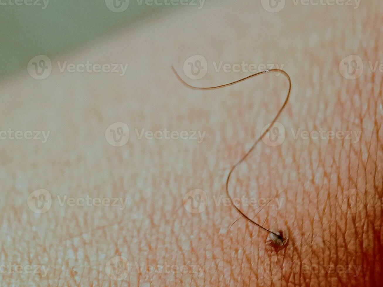 Môle tache de naissance naevus macro photo sur Humain peau avec cheveux. proche vers le haut, flou Contexte avec bokeh images.